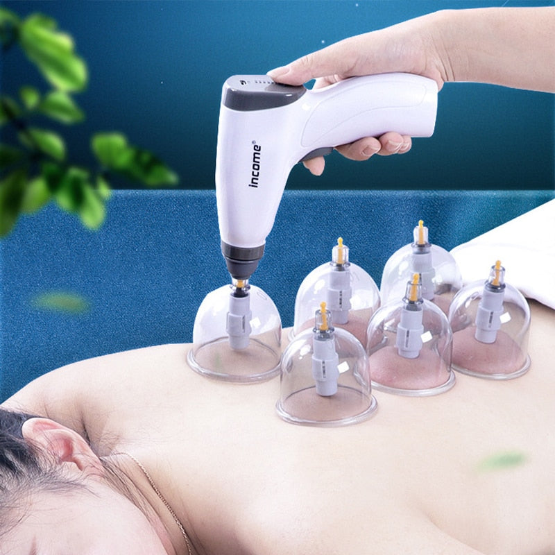 Vacuum Cupping Suction Therapy Device