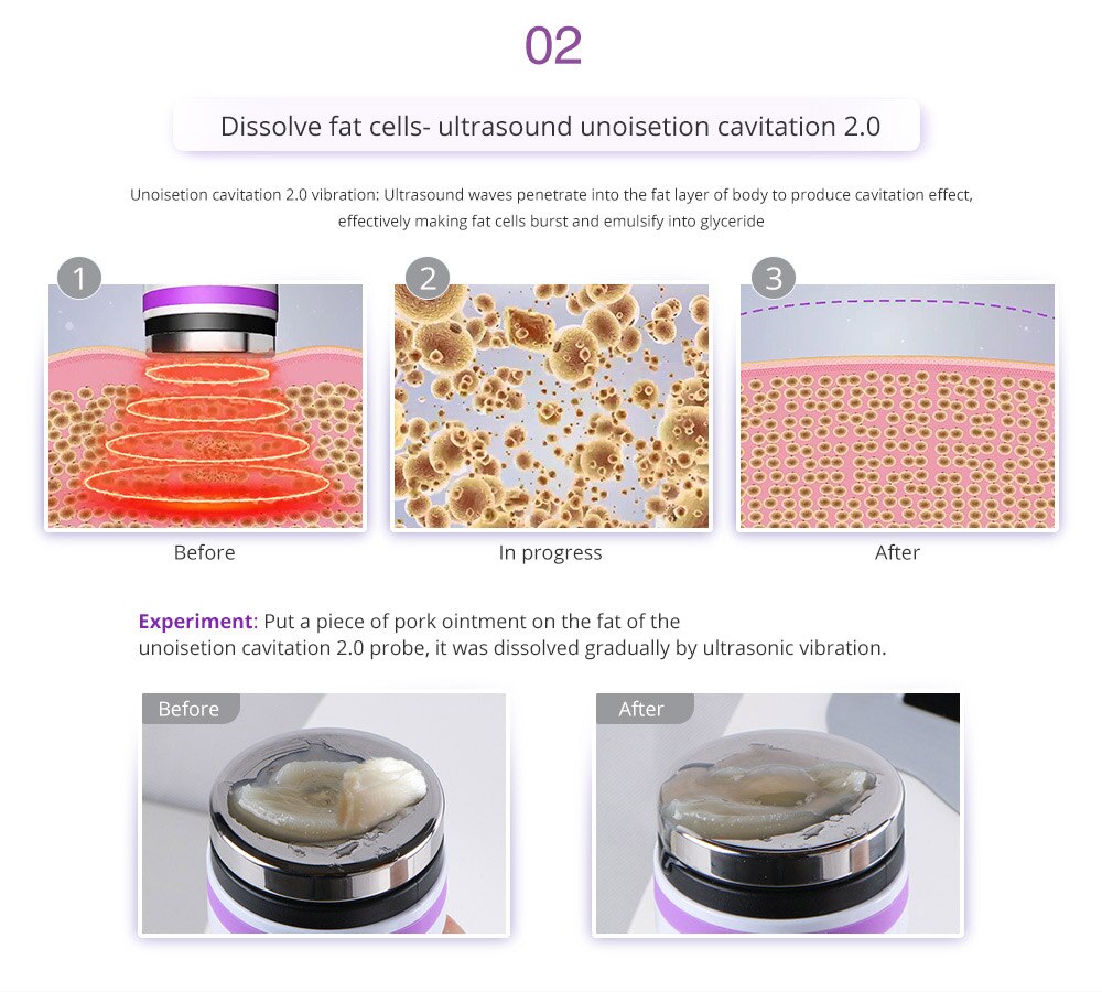 9 In 1 Ultrasound 40K Cavitation Vacuum Therapy Body Suction Slimming Micro-current Skin Care Face Lifting Beauty Machine 6 in 1